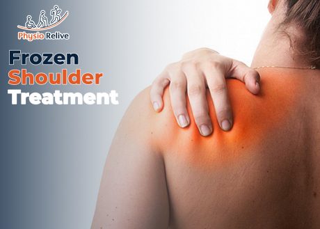 frozen shoulder